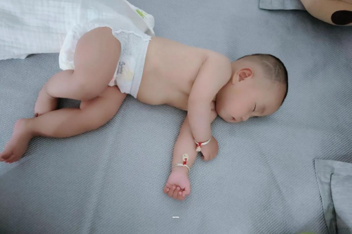 通许宝宝脸上有白色斑块 通许宝宝脸上有白色斑块